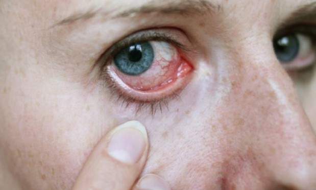 Doença de olho seco e diabetes: estudo revela necessidade de triagem